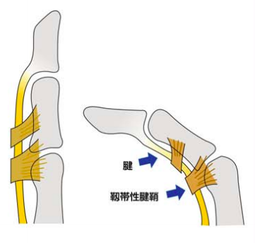 膝崩れの原因を理解する