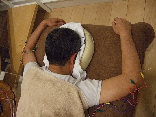 リハビリしても改善しない野球肩