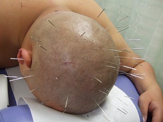 銀座そうぜん鍼灸院