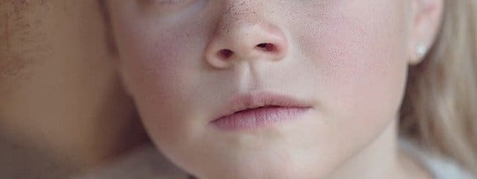 赤ら顔の鍼灸 原因 定義 症状 銀座そうぜん鍼灸院 深層筋 自律神経 銀座 築地