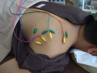 頚肩腕症候群 銀座そうぜん鍼灸院 深層筋 自律神経 銀座 築地