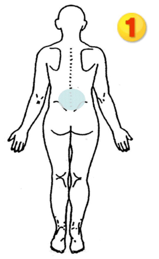 腰椎から起きる膝崩れ