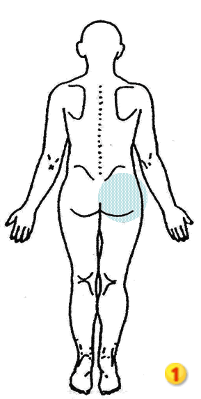 梨状筋症候群について 銀座そうぜん鍼灸院 深層筋 自律神経 銀座 築地
