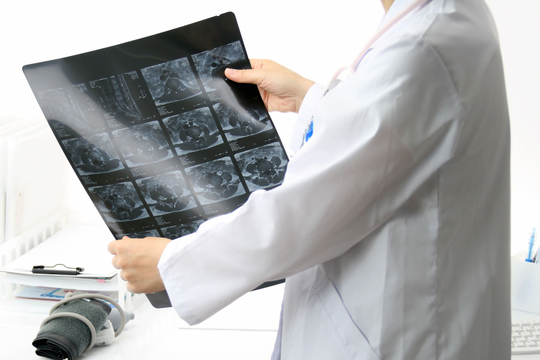 頚肩腕症候群 銀座そうぜん鍼灸院 深層筋 自律神経 銀座 築地